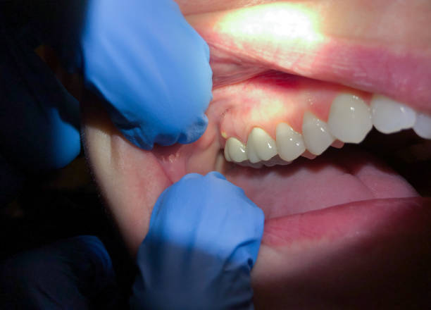 Best Broken or Cracked Tooth Emergency Dentist in Macedonia, OH
